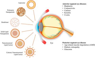 Lipid-based nanoparticles: innovations in ocular drug delivery